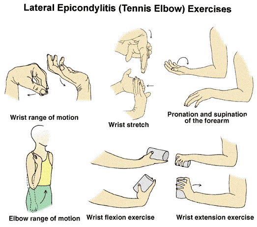 Lateral Epicondylitis, a.k.a. “Tennis Elbow” | Austin Sports Therapy